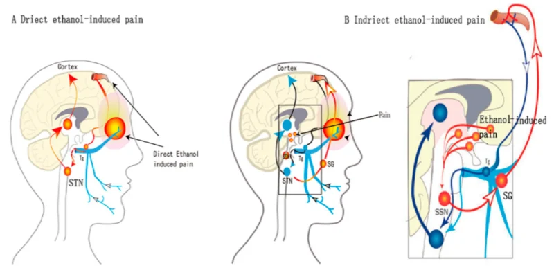 Vì sao nhiều người bị đau đầu sau khi uống rượu?